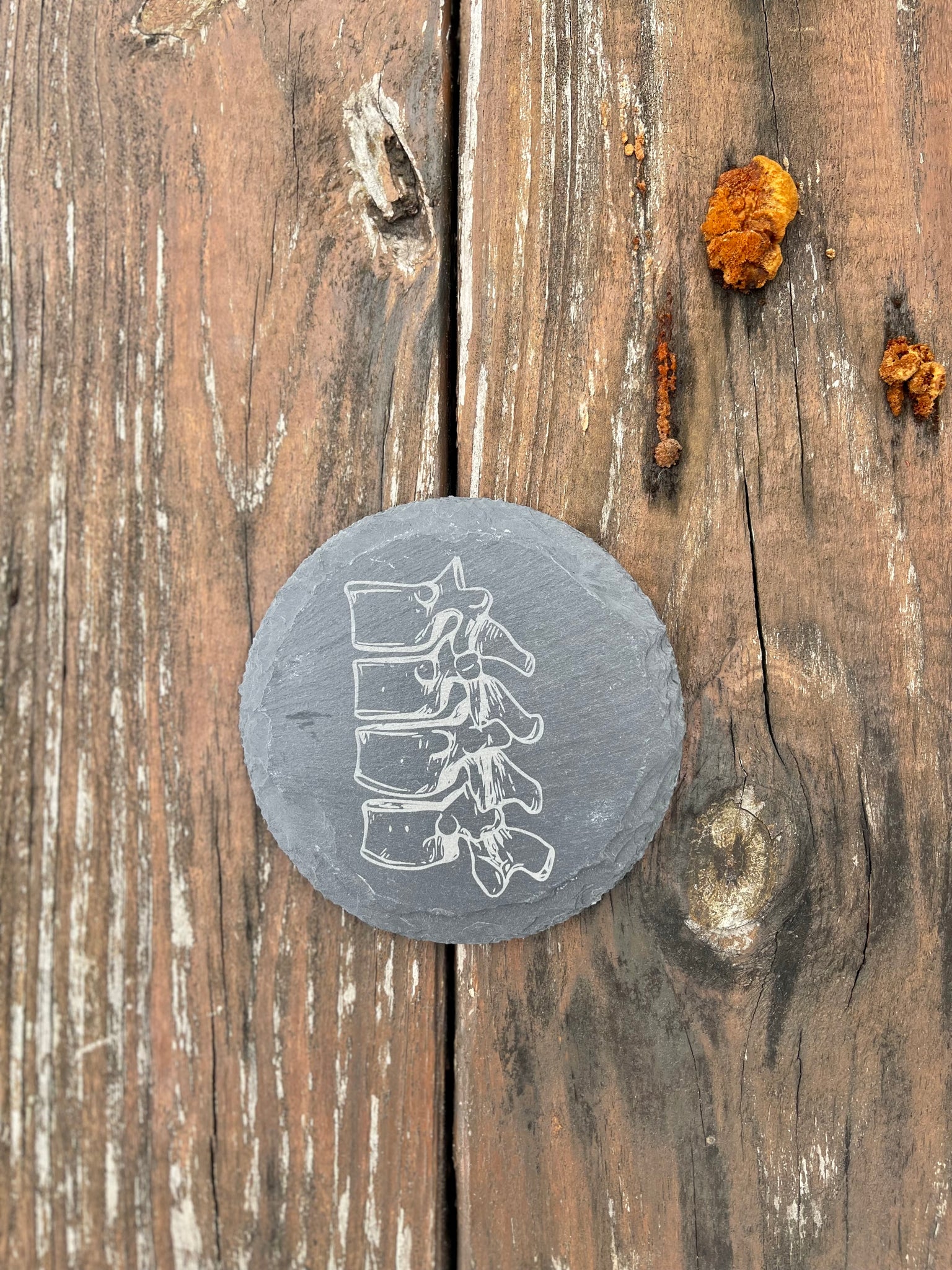 Spinal Column Anatomy Engraved Slate Coaster